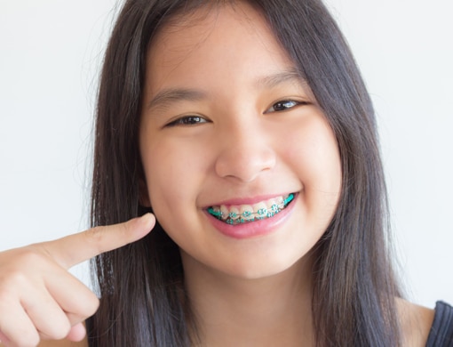 Types of Braces in Salem & Keizer OR - McDonald Orthodontics