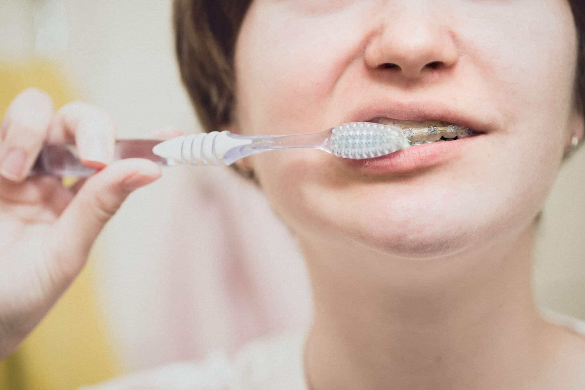 girl with braces brushing her teeth