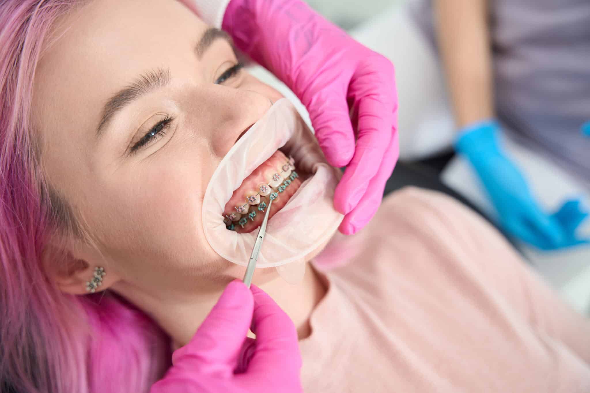 Orthodontist checks the system for the correction of the dentition orthodontist checks the system for the correction of the dentition