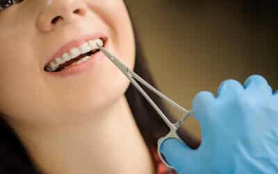 woman with ceramic braces on teeth at the dental office